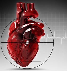 Инфаркт миокарда — причины, симптомы, первая помощь и лечение